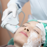 How HIFU Treatment in Singapore Is Transforming Facelifts